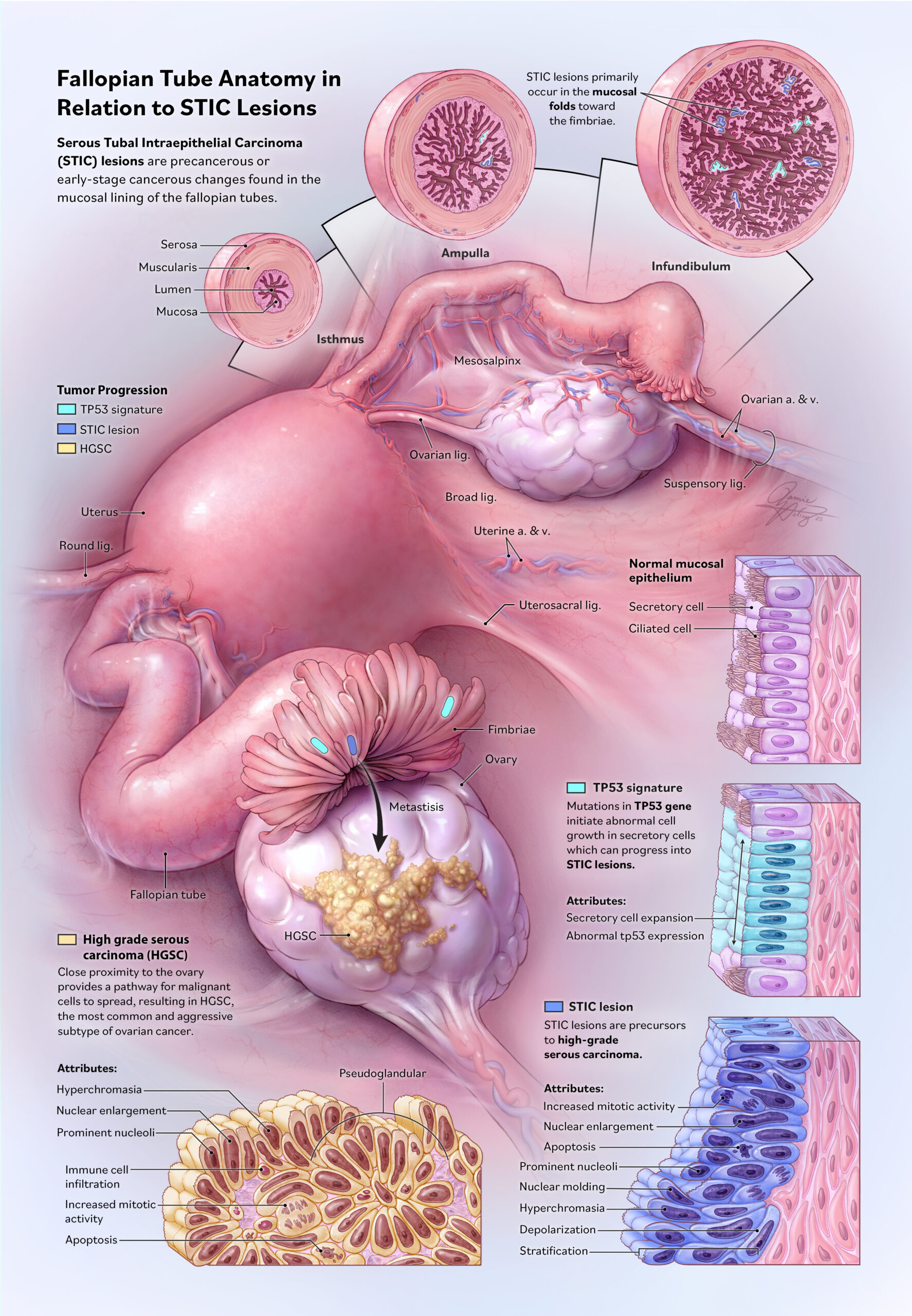 Hefley-Jamie_III_Anat_STICLesions
