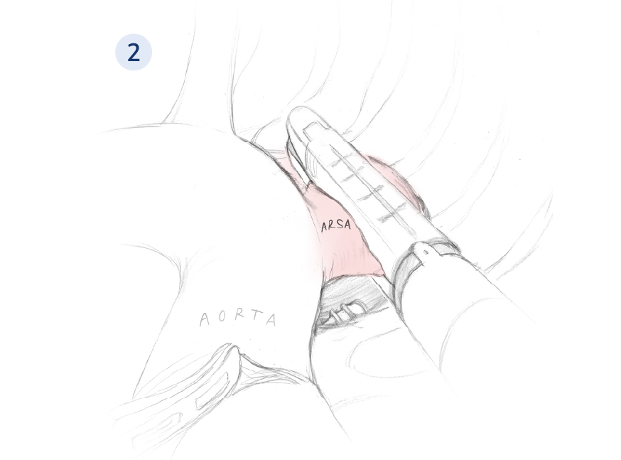sketch2